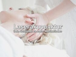 Laserakupunktur